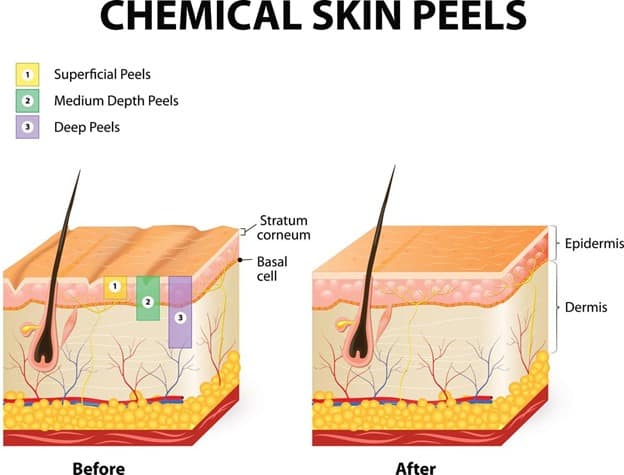 Pace Pharmacy compounds chemical peels